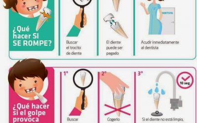 Mi hijo se ha caído y se ha golpeado o roto un diente definitivo ¿Qué hago? (Parte II)